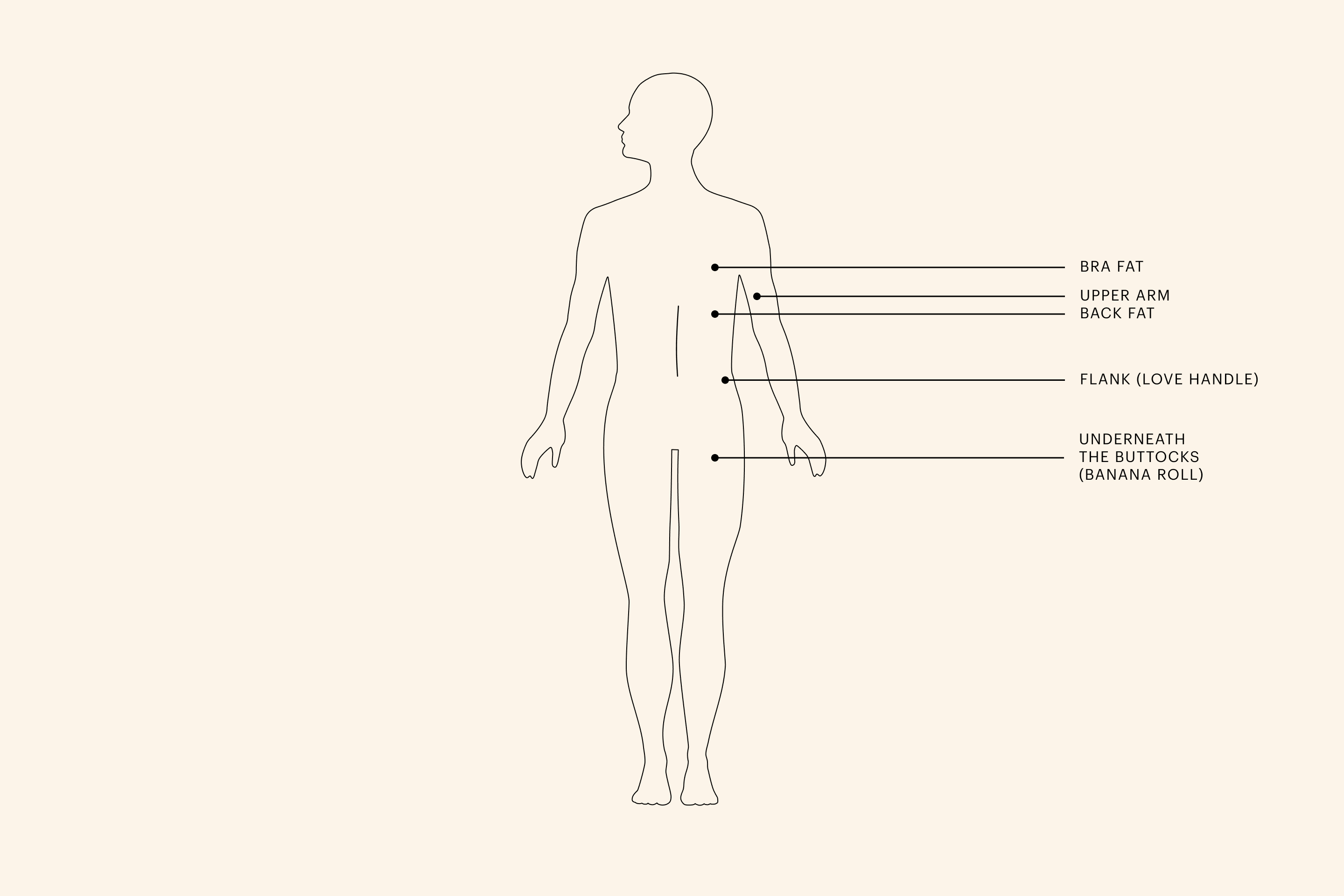 CoolSculpting treatment areas