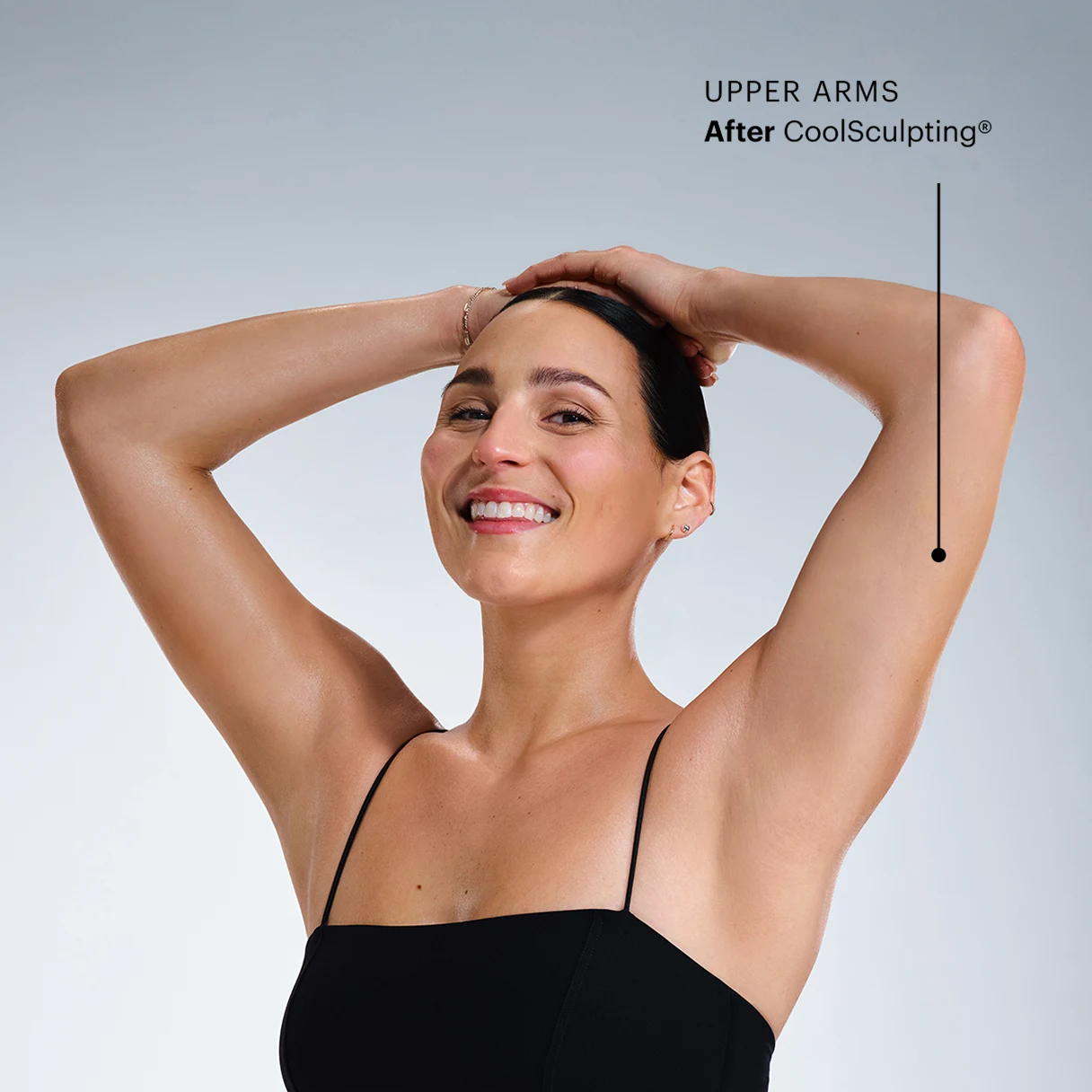 Does CoolSculpting® tighten upper arms?